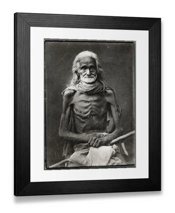 Framed Print : Portrait of Emaciated Man Framed Print : Portrait of Emaciated Man