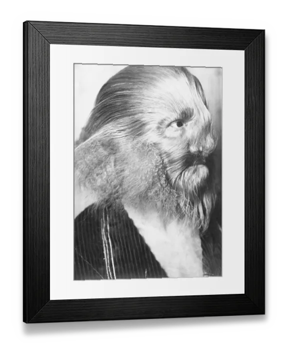 Framed Print : Portrait of a Genetically Hairy Man