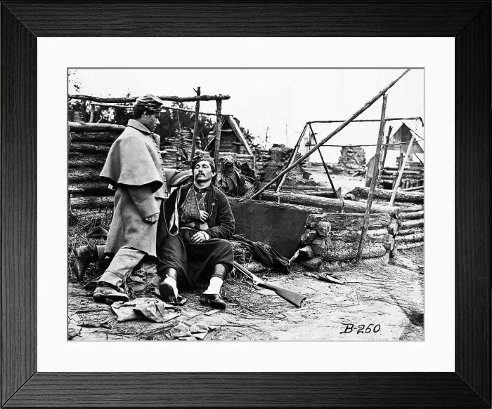 Framed Print : Wounded Soldier During the American Civil War Framed Print : Wounded Soldier During the American Civil War