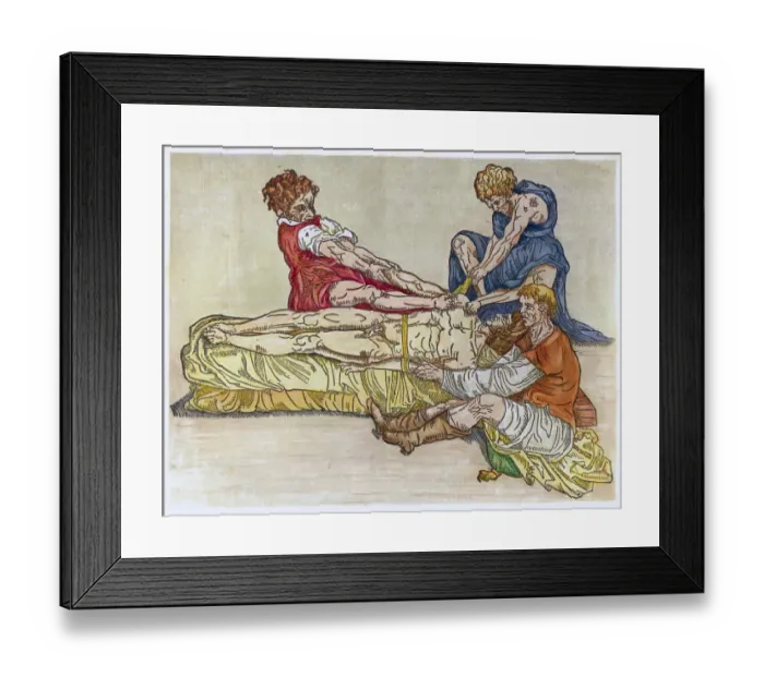 Framed Print : Physician and Assistants Preparing a Dislocated Shoulder Framed Print : Physician and Assistants Preparing a Dislocated Shoulder