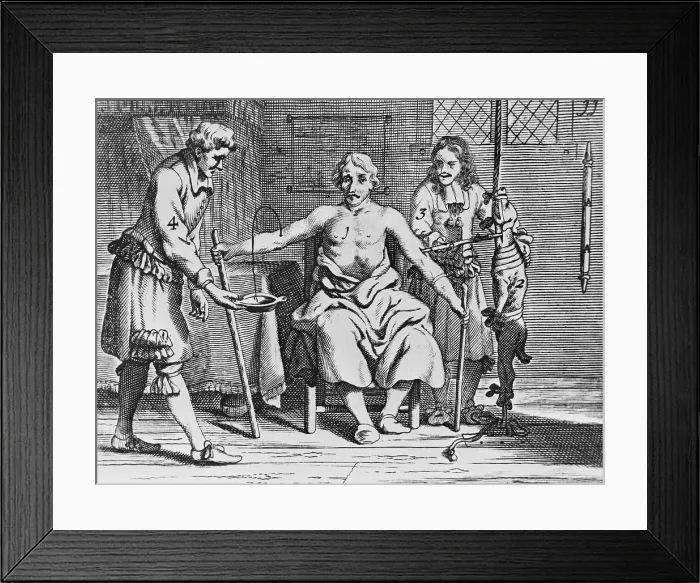 Framed Print : Physicians and Patient During Early Blood Transfusion Framed Print : Physicians and Patient During Early Blood Transfusion