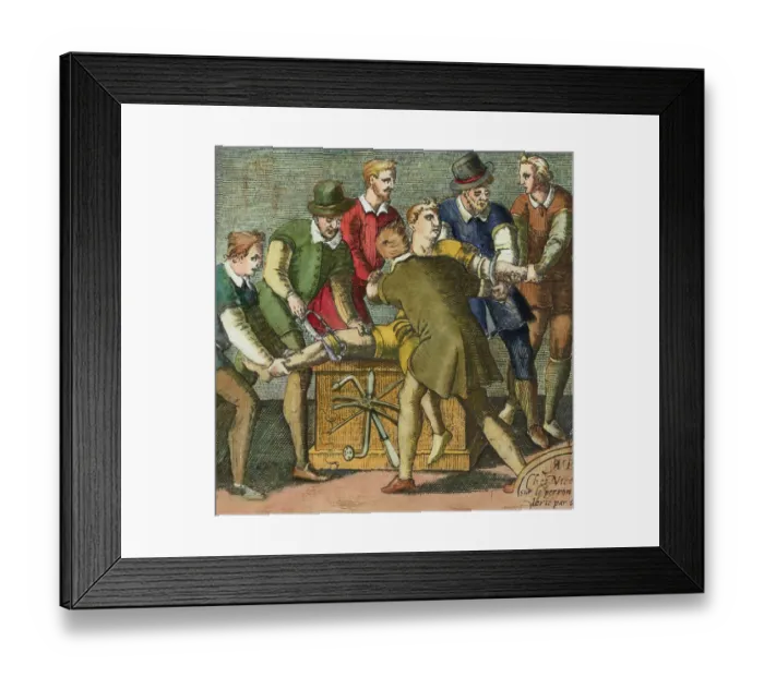 Framed Print : Physician and Assistants during Early History Leg Amputation Framed Print : Physician and Assistants during Early History Leg Amputation