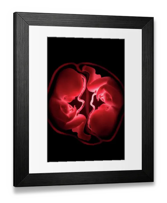 Framed Print : Twins. A conceptual image depicting a womb containing stylized twin fetus Framed Print : Twins. A conceptual image depicting a womb containing stylized twin fetus