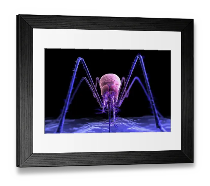 Framed Print : Mosquito bite Framed Print : Mosquito bite