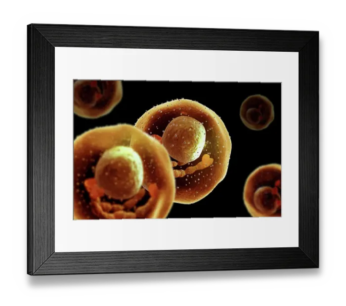 Framed Print : Mast cells Framed Print : Mast cells