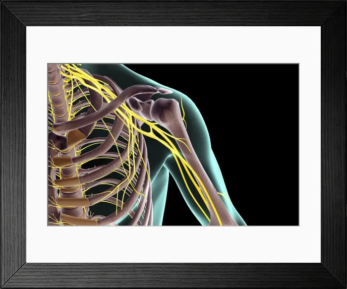 Framed Print : The nerves of the shoulder Framed Print : The nerves of the shoulder