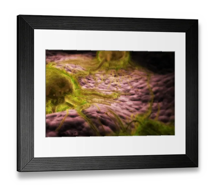 Framed Print : A conceptual visualization of breast cancer cells Framed Print : A conceptual visualization of breast cancer cells