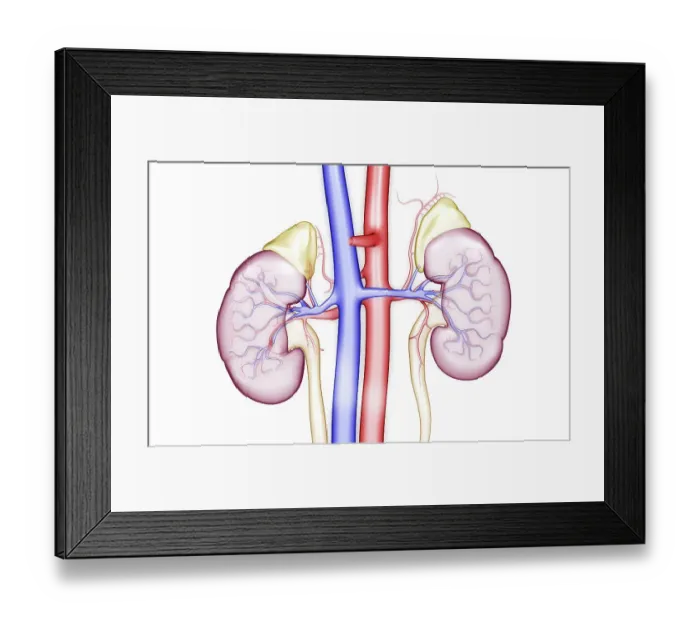 Framed Print : Blood supply of the kidneys Framed Print : Blood supply of the kidneys