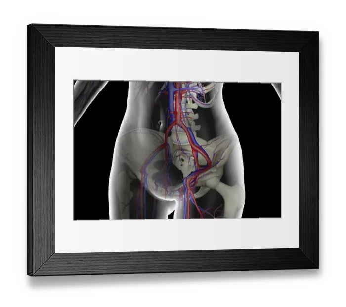 Framed Print : The blood supply of the lower body Framed Print : The blood supply of the lower body