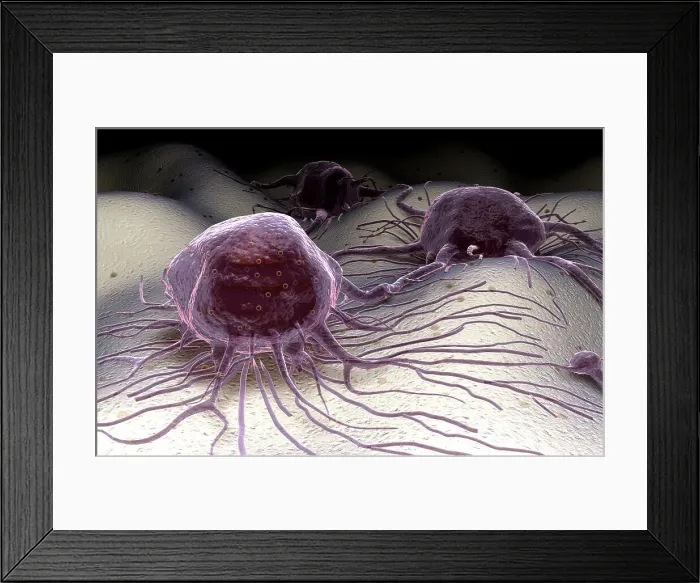 Framed Print : Cancer cells Framed Print : Cancer cells