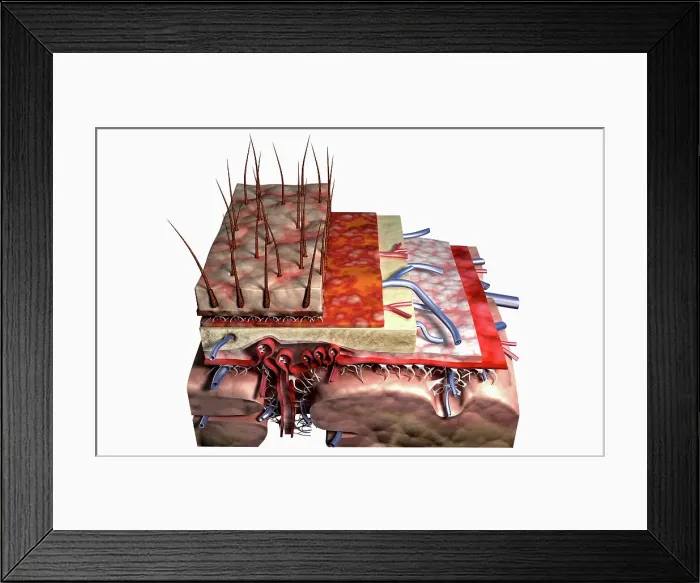 Framed Print : Sectional anatomy of the scalp