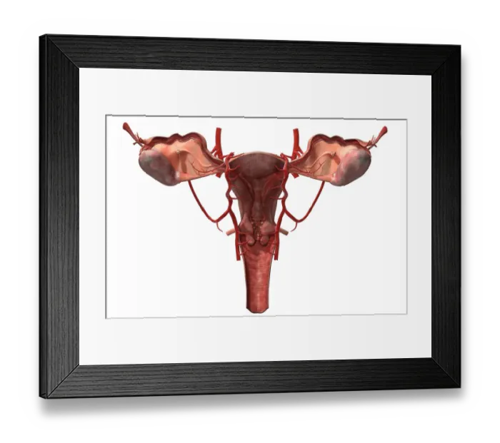 Framed Print : The arteries of the female reproductive system Framed Print : The arteries of the female reproductive system