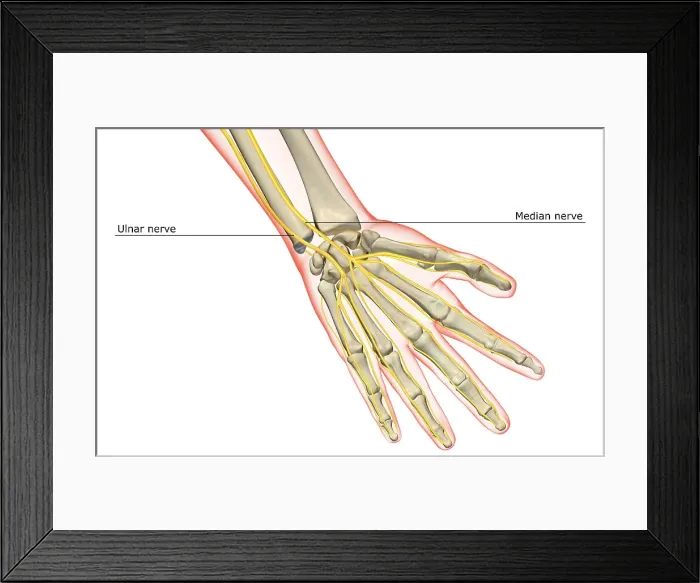 Framed Print : The nerves of the hand Framed Print : The nerves of the hand