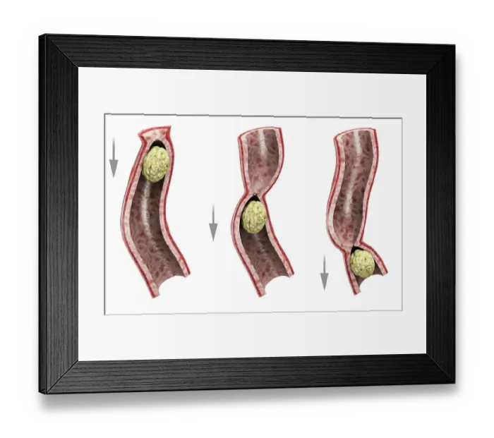 Framed Print : Peristalsis Framed Print : Peristalsis