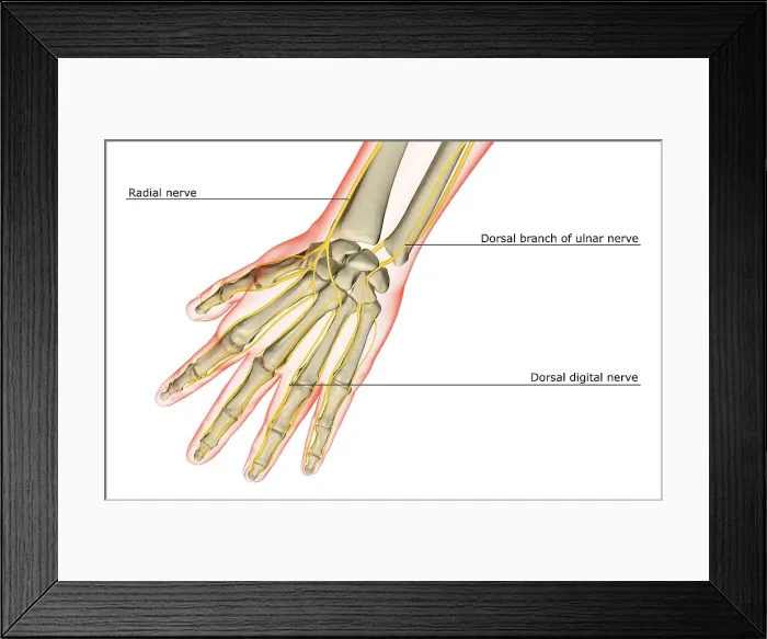 Framed Print : The nerves of the hand Framed Print : The nerves of the hand