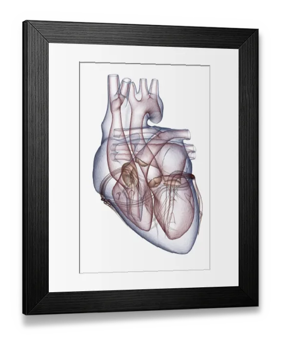 Framed Print : The heart. aorta, aortic arch, atria, atrium, bicuspid valve Framed Print : The heart. aorta, aortic arch, atria, atrium, bicuspid valve