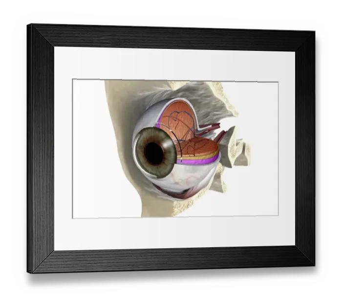 Framed Print : Anterior angled view of the right eyeball exposed in the eye socket Framed Print : Anterior angled view of the right eyeball exposed in the eye socket