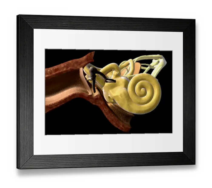 Framed Print : Anatomy of the ear Framed Print : Anatomy of the ear