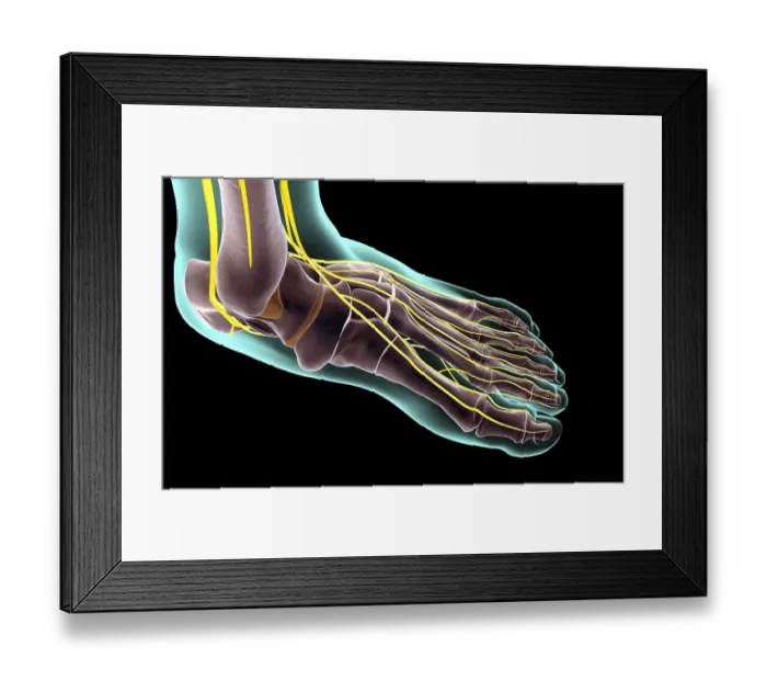 Framed Print : The nerves of the foot Framed Print : The nerves of the foot