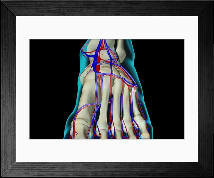 Framed Print : The blood supply of the foot Framed Print : The blood supply of the foot