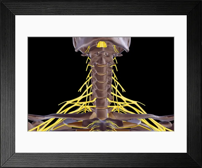 Framed Print : The nerves of the neck Framed Print : The nerves of the neck