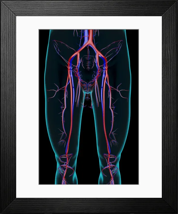 Framed Print : The blood supply of the lower limb Framed Print : The blood supply of the lower limb