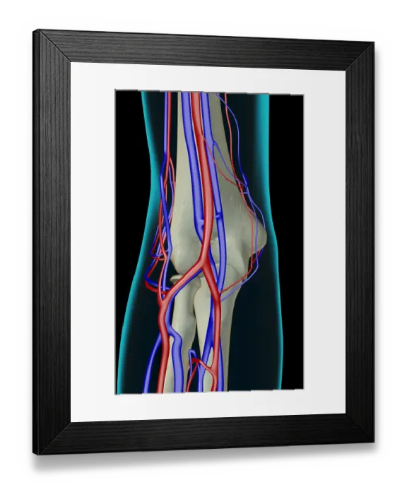 Framed Print : The blood supply of the elbow Framed Print : The blood supply of the elbow