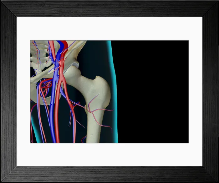 Framed Print : The blood supply of the hip Framed Print : The blood supply of the hip
