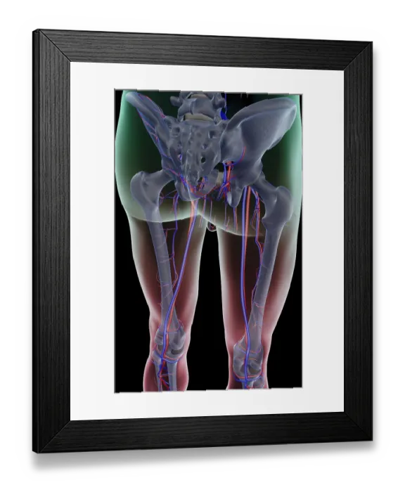 Framed Print : The blood supply of the lower limb Framed Print : The blood supply of the lower limb