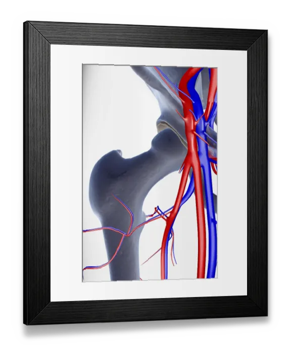 Framed Print : The blood supply of the hip Framed Print : The blood supply of the hip