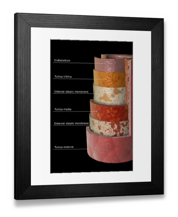 Framed Print : The arterial wall Framed Print : The arterial wall