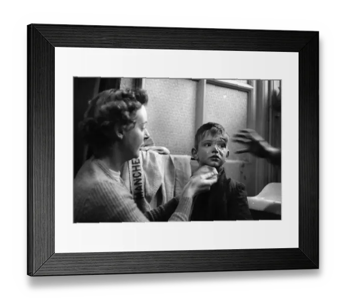 Framed Print : Cut Forehead