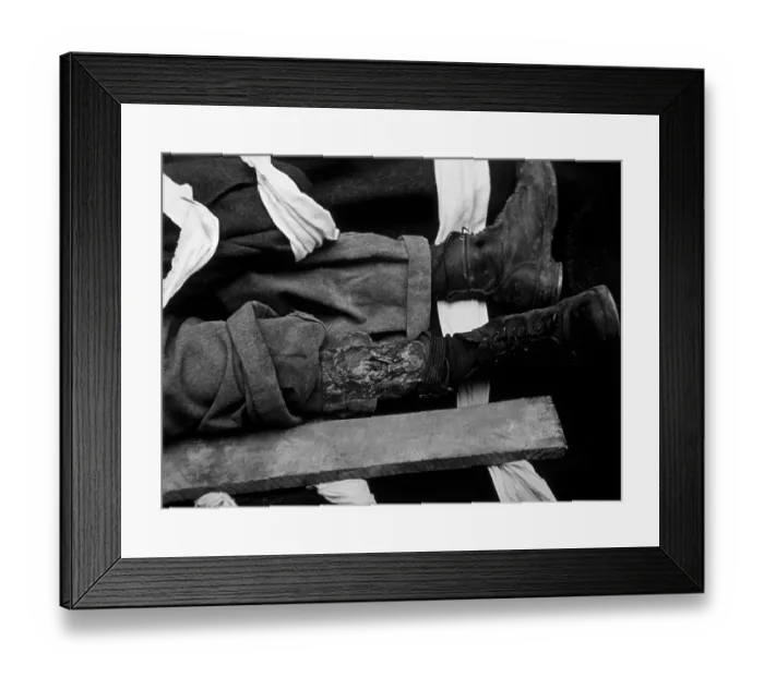 Framed Print : Injured Ankle Framed Print : Injured Ankle