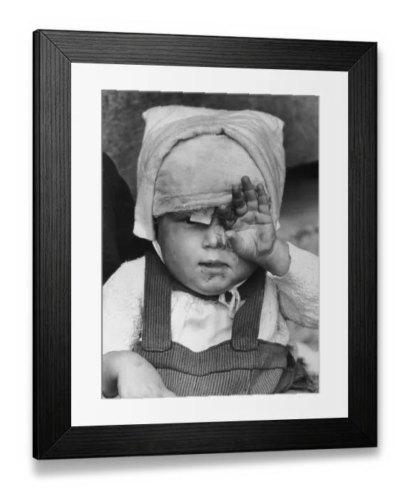 Framed Print : Child Refugee