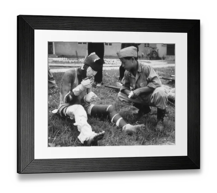 Framed Print : Burn Victim