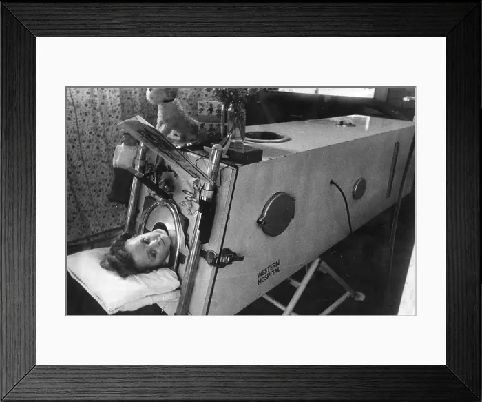 Framed Print : Infantile Paralysis Framed Print : Infantile Paralysis