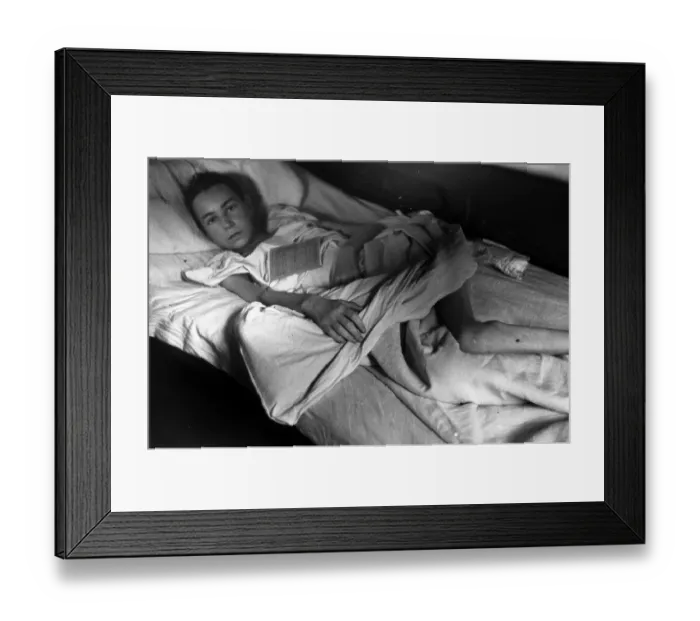 Framed Print : Recovering Child Framed Print : Recovering Child