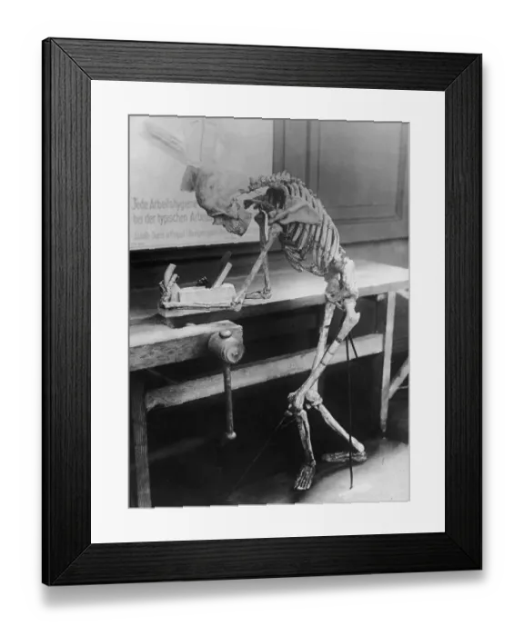 Framed Print : Worked To The Bone