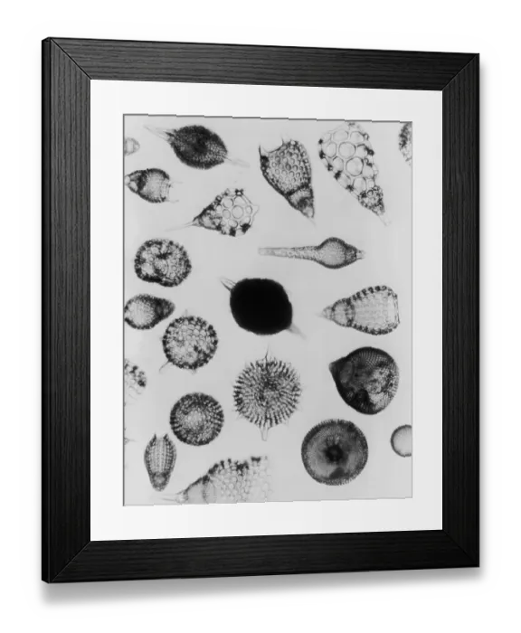 Framed Print : X-Ray Amoeboids Framed Print : X-Ray Amoeboids