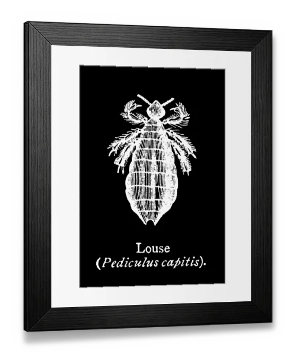 Framed Print : Old engraved illustration of insect, Head louse (Pediculus humanus capitis) Framed Print : Old engraved illustration of insect, Head louse (Pediculus humanus capitis)