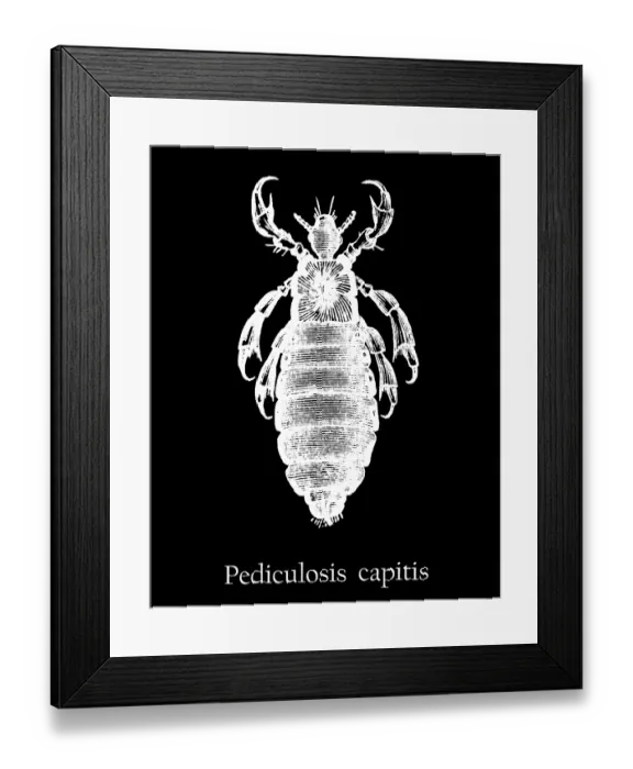 Framed Print : Old engraved illustration of insect, Head louse (Pediculus humanus capitis) Framed Print : Old engraved illustration of insect, Head louse (Pediculus humanus capitis)