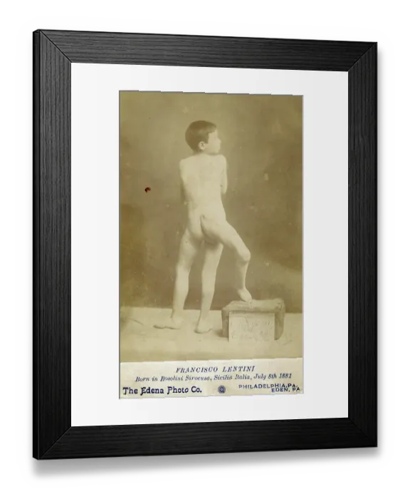 Framed Print : Souvenir Cabinet Card of Three-Legged Boy, Francisco Lentini, circa 1890 Framed Print : Souvenir Cabinet Card of Three-Legged Boy, Francisco Lentini, circa 1890
