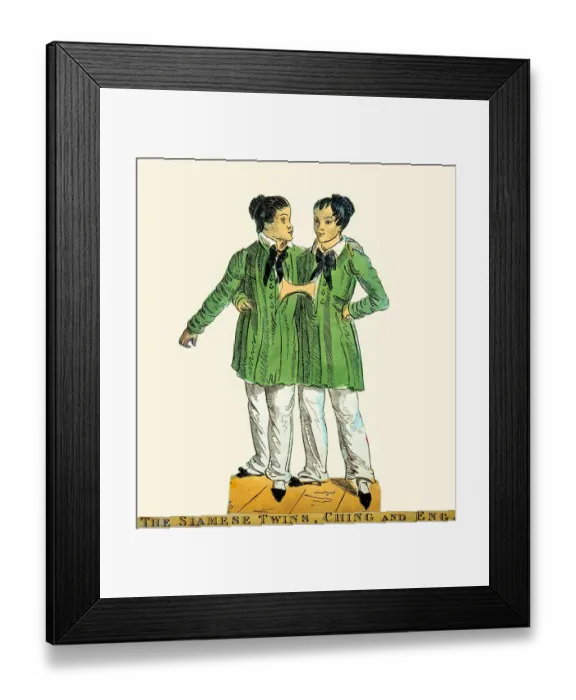Framed Print : The Siamese Twins, Chang and Eng Framed Print : The Siamese Twins, Chang and Eng