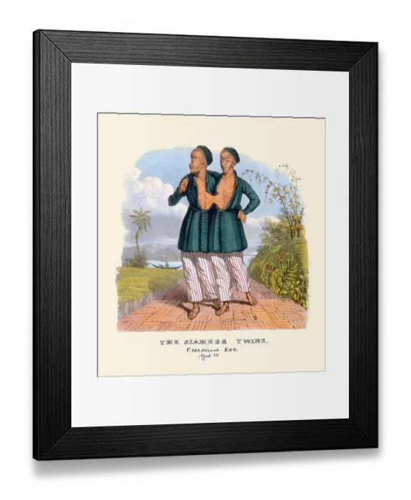 Framed Print : The Siamese Twins, Chang and Eng, age 18 Framed Print : The Siamese Twins, Chang and Eng, age 18