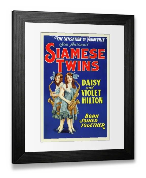 Framed Print : Hilton Sisters - Siamese Twins
