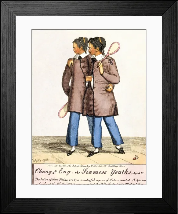Framed Print : Chang, & Eng. the Siamese Youths. Aged 18 Framed Print : Chang, & Eng. the Siamese Youths. Aged 18