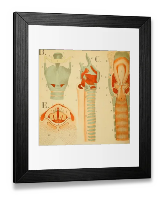 Framed Print : Larynx. Color print depicting several views of the human larynx, including Framed Print : Larynx. Color print depicting several views of the human larynx, including