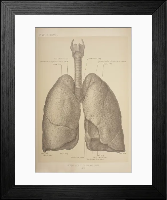 Framed Print : Anterior View Of The Trachea & Lungs Framed Print : Anterior View Of The Trachea & Lungs