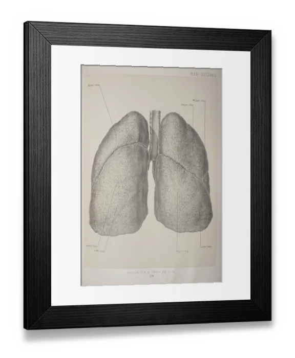 Framed Print : Posterior View Of The Trachea & Lungs