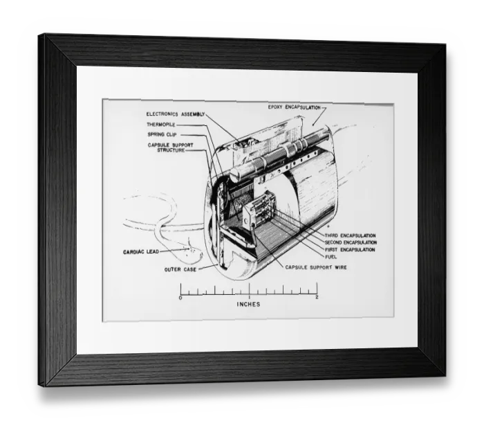 Framed Print : Nuclear-Powered Cardiac Pacemaker